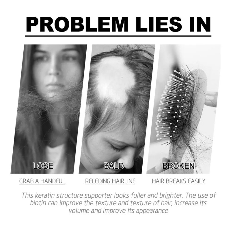 R Aceite Para El Crecimiento Del Cabello, 2 Unidades, 60