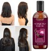 Generic Onion Hair Oil for Hair Growth and Hair Fall