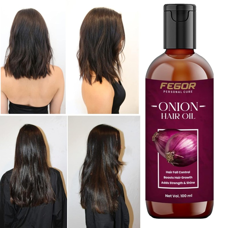 Generic Onion Hair Oil for Hair Growth and Hair Fall