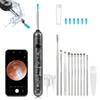 FoxSync 5MP 2560x1920 HD Ear Wax Removal Tool with Camera
