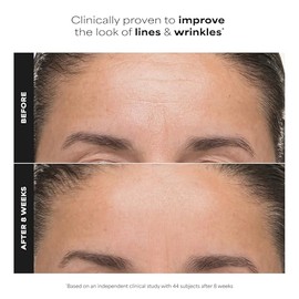 Paula’s Choice 6% Mandelic Acid + 2% Lactic Acid Exfoliant, Gentle Daily AHA Exfoliation for Discoloration, Bumpy Texture & Radiance, for Sensitive Skin, Fragrance-Free