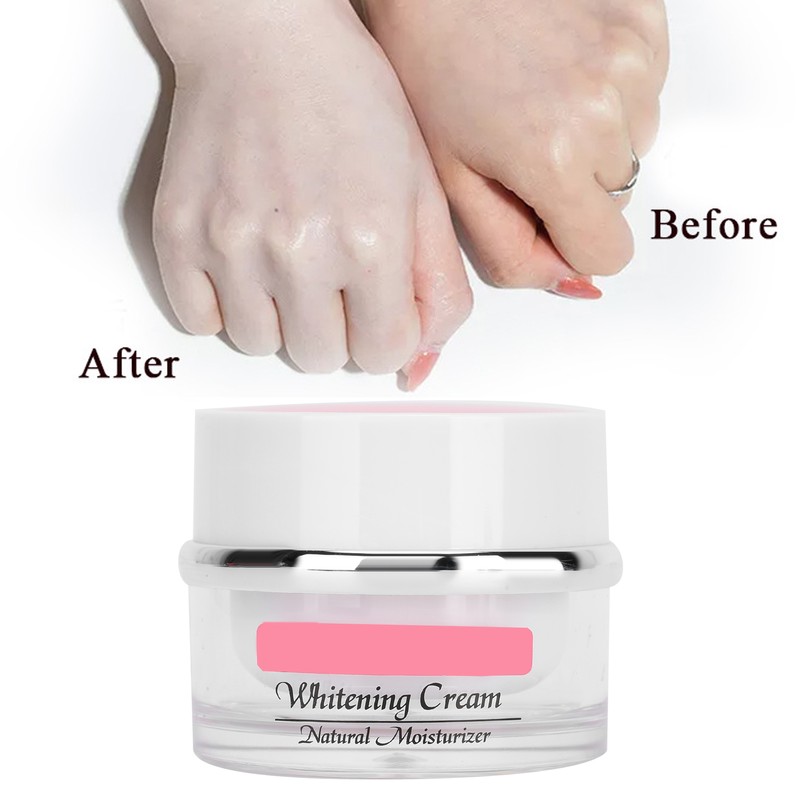 Face Whitening Brightening Cream Freckle Removal Skin Moisturizing Nourishing Cream