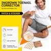 Tiras para uñas encarnadas, 60 unidades. Parche corrector de uñas