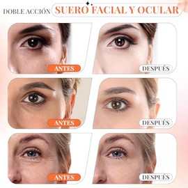 Serum Vitamina C Ácido Hialurónico + Vitamina E | Skin Care | 95% Ingredientes Naturales | Luminosidad,Firmeza y Tono más Uniforme | Suero Hidratante,