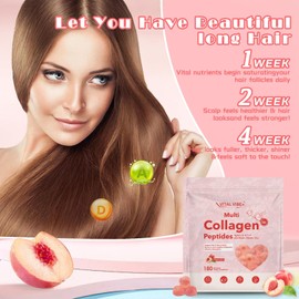 180 Gummies 5000mg Collagen Gummies, Marine Collagen, Hydrolyzed Collagen Peptides for Women, Type I, II, & III, Biotin, Vitamin C, Advanced Skin Support & Hair Growth, 2 Month Supply