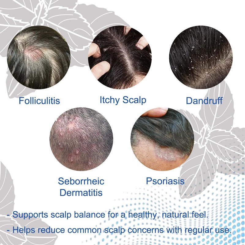 Folliculitis Shampoo for Itchy, Flaky Scalp - Purifying Formula for