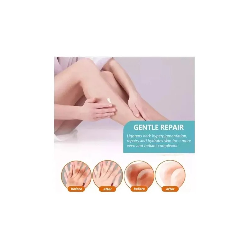 Crema Fixderma Nigrifix Para La Acantosis Nigricans Fbg Color Rojo