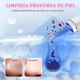 Limpiador Facial Ultrasnico, Exfoliante Facial Limpiador Para Limpieza Facial Mquina de Belleza Cuidado Personal de la Piel Herramientas de Belleza,  