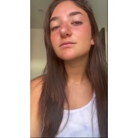 Gel Hidratante Aloe 99% Chok Chok