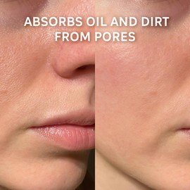 Zermat Skin, Charcoal Face Mask, 2.83 Oz.