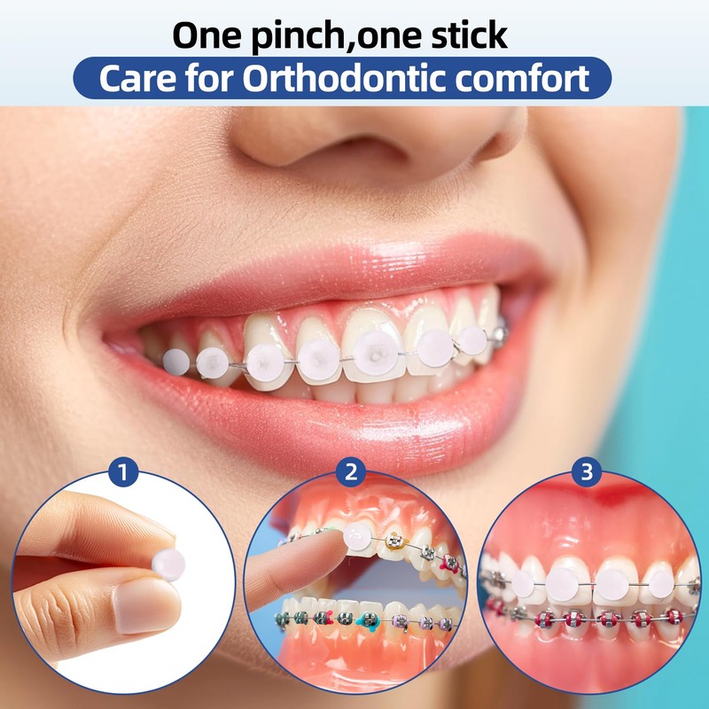 RAZOKO Orthodontic Wax for Braces Wax Dots 90 Individual Hygienic