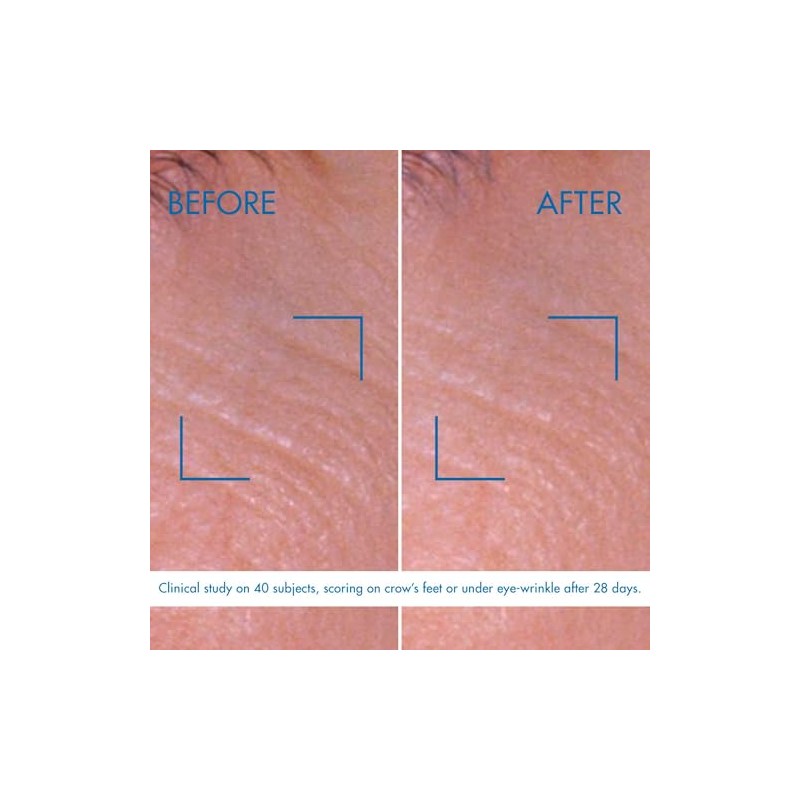 Biotherm Crema Reafirmante para Ojos Pro-Retinol, 15 ml