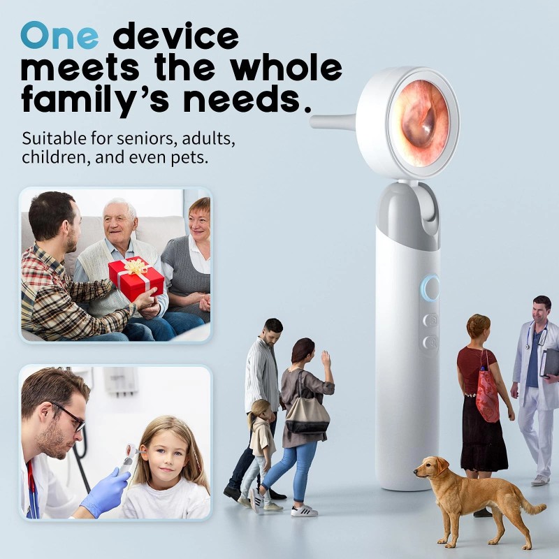 Aertnelz Otoscope Ear Camera with 1.38” Screen, 1080P HD Ear
