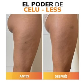Celu-Less Kilani Crema de Celulitis Super Concentrada - Cafena Pura, Elastina y Toronja - Reductor  Reafirmante - Flacidez - Piel de Naranja - Efecto 