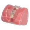 Demonstration Orthodontics Dental Model Disassembled Resin Teeth Model for Teaching