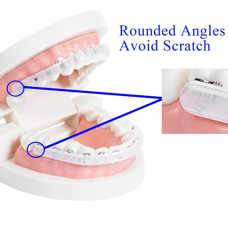 Comfort Cover for Braces, Lip Protector Mouth Guard Lip Cushion