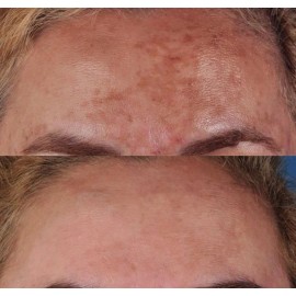 Crema Zo Skin Health Pigment Control 80ml 18+ 80g