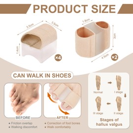 Rbleote Pack of 4 Toe Separators, Reusable Hallux Valgus Correction, Unisex Hammer Toe Correction, Soft and Breathable, for Overlapping Toes and Bunion Pain (Skin Tone)