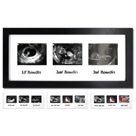 IHEIPYE Triple Sonogram Pregnancy Frame – Baby Ultrasound Picture Frame with Story for Expecting Parents, Baby Shower Frame, Baby Grow Through All Three Trimesters Frame, Nursery Decor, Black