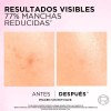 Sérum L'oréal Paris Anti-manchas Con Ácido Glicólico 30ml