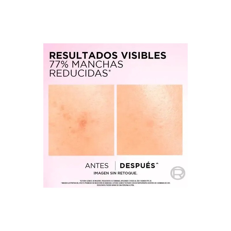 Sérum L'oréal Paris Anti-manchas Con Ácido Glicólico 30ml