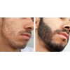 Barba Gel Crema Barba Bigote Barba Oferta Novocrin Barba