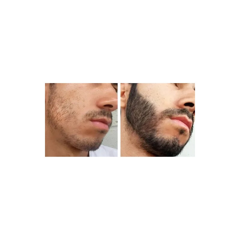 Barba Gel Crema Barba Bigote Barba Oferta Novocrin Barba