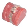 Demonstration Orthodontics Dental Model Disassembled Resin Teeth Model for Teaching