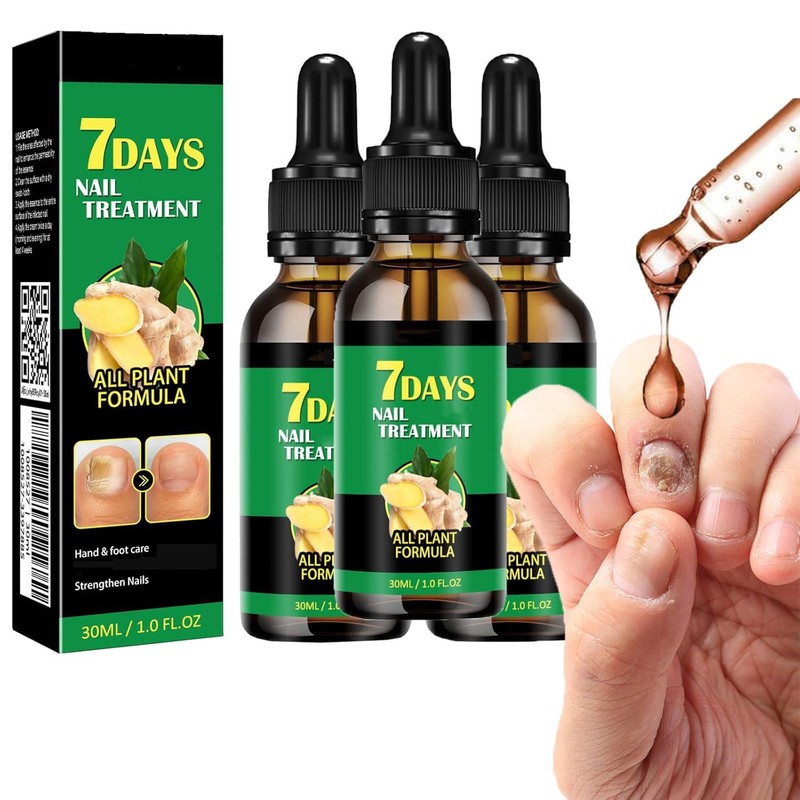 Ginger Nail, Tratamiento de Uñas con Jengibre, Soporte para Uñas,