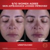 Oreal Paris Revitalift Triple Power Crema Hidratante Facial Cuello Antienvejecimiento