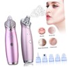 Healeved Electric Blackhead Suction Device Blackhead Cleaning Blackhead Extractor