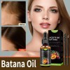 2pcs Aceite De For El Crecimiento Del Cabello Con-top 1