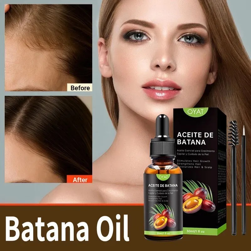 2pcs Aceite De For El Crecimiento Del Cabello Con-top 1