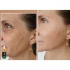 3 Aceite De Moringa Antiarrugas Anti Manchas Antiedad Natura
