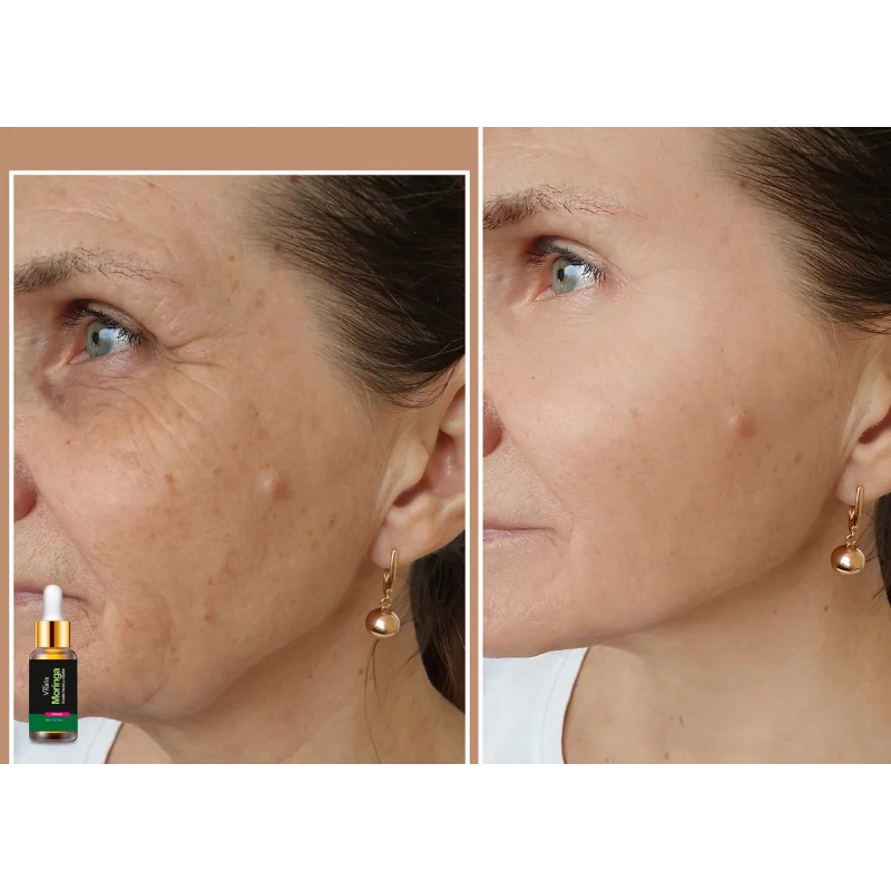 3 Aceite De Moringa Antiarrugas Anti Manchas Antiedad Natura