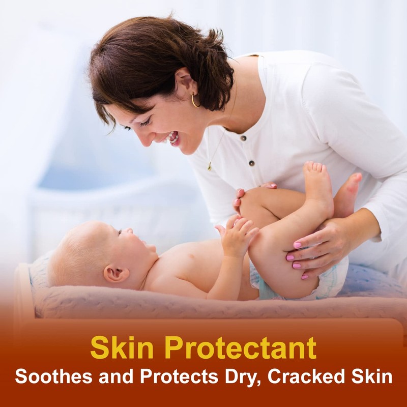 CareAll Vitamin A&D Ointment 15 oz. Helps Treat and Prevent