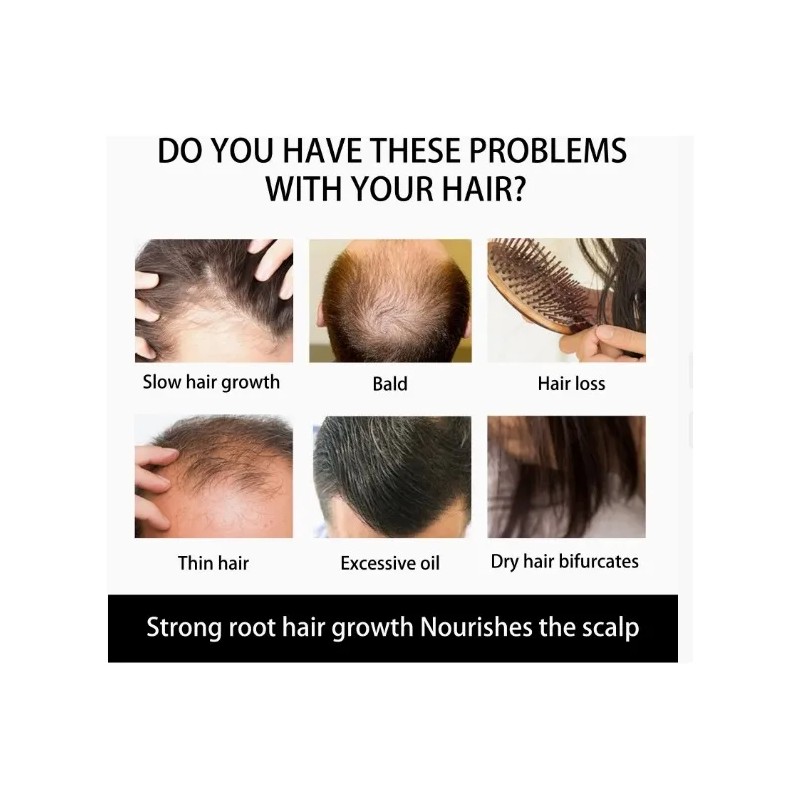 Dermaroller Barba Rodillo Facial Regenerador Aguja 0,5 Mm