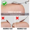 Econtal Callus remover, callus rasp foot, callus scraper for foot