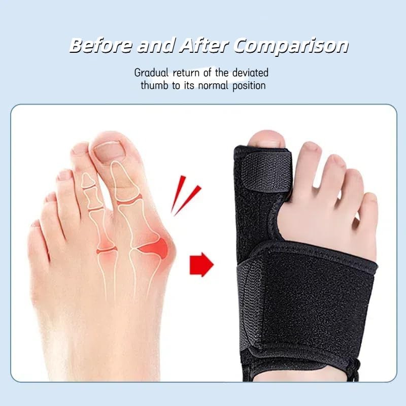 Ristpal Big Toe Splint for Broken, Fracture Fixator Protectors Support