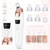 Professional Blackhead Vacuum for Pore Care – Rechargeable Facial Suction
