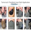 Tamarack Prosthetic Liner Patch with GlideWear Technology for Amputees (4"
