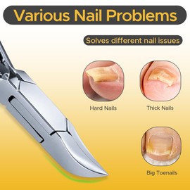 Strong Nail Cutter for Thick Toenails | Nail Clippers for Tough, Stubborn & Fungal Nails, Heavy Duty Chiropody Podiatry Cutter