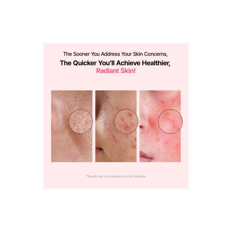 Veganifect [Veganifect]Lifting And Balancing Fig Chestnut Pore Tight Ampoule 50ml