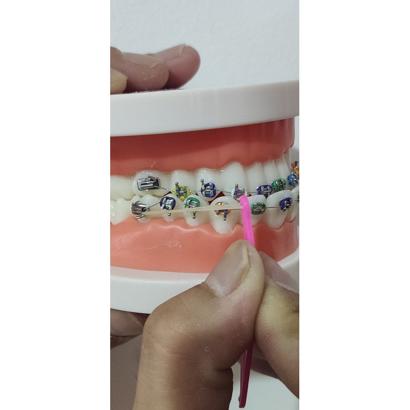 RZJZGZ Dental Elastic Rubber Bands Placers for Braces Disposable Plastic