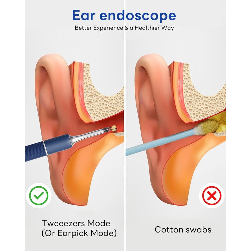 MEKK Ear Wax Removal Kit S5 with 10 MP Camera,