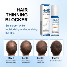 BSMAX 2pcs Genthair DHT Blocker for Men,Genthair Hair Growth Roller, Genthair DHT Blocker Roll On for Men,Hair Growth Serum,Hair Thinning Blocker