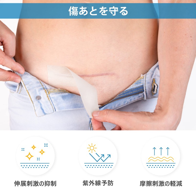 手術後 帝王切開 傷あ 米国式デザインテスト シリコーンゲルテープ ４センチ×150 センチ, ４センチ×300 センチ (４センチ×１５０センチ)