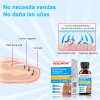 Tratamiento Rápido De Hongos En Las Uñas De Los Pies