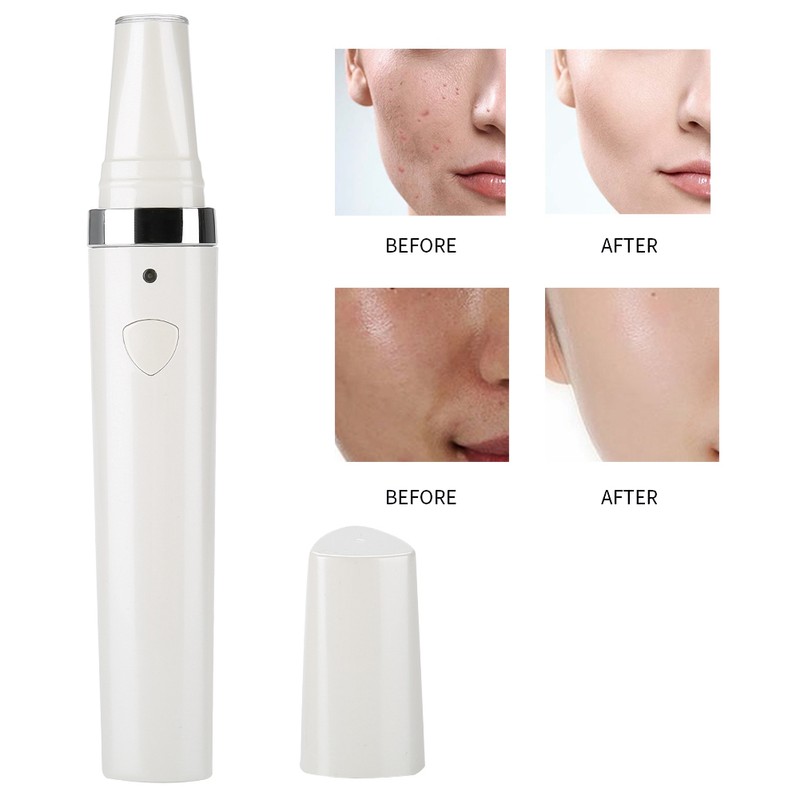 3 IN 1 Acne Removal Pen for Scar Repair Skin