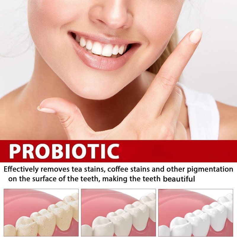 BEAUTRAVA Sp-6 Ultra Toothpaste,Sp - 6 Probiotic Toothpaste,Deep Cleaning Care